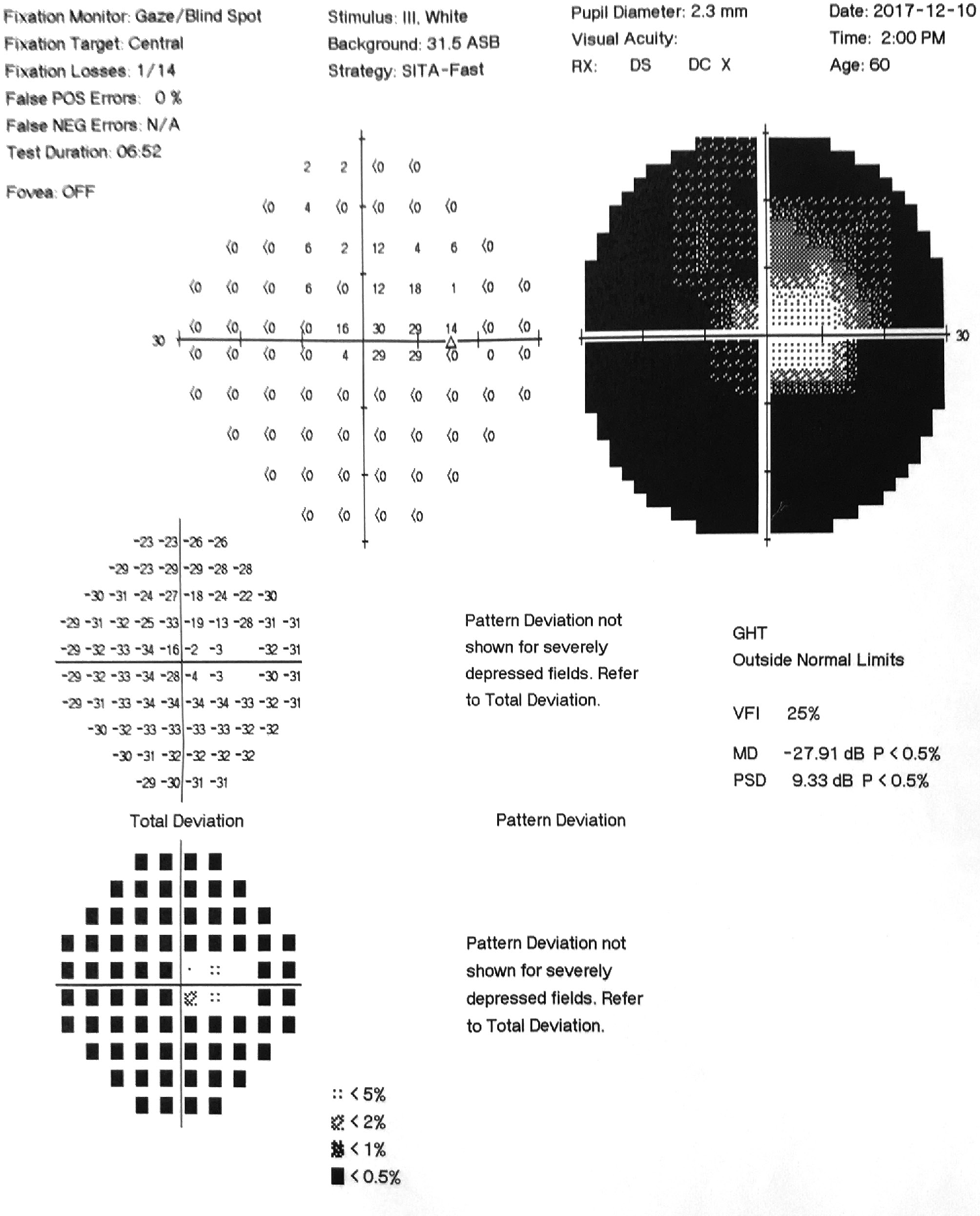 视野计 - Perismart - RODENSTOCK Instruments/罗敦斯德 - 静止视力检查 / 台式