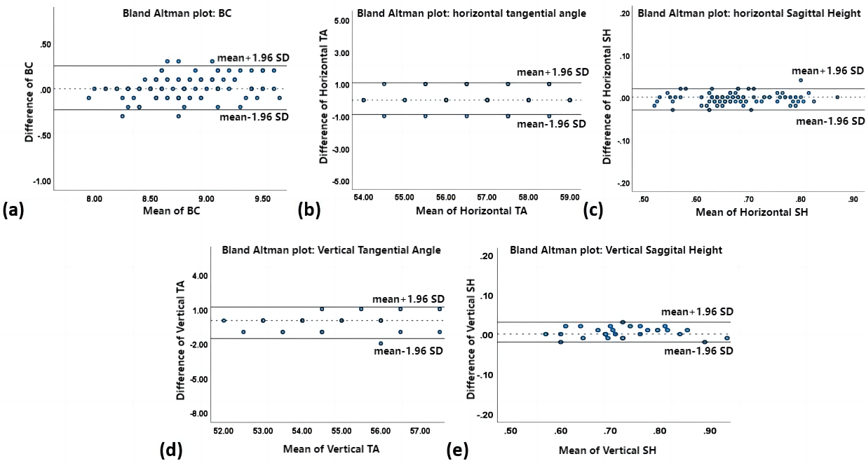 Figure 4 Bland-Altman plots for lens parameters generated by Easyfit Software at two conditions