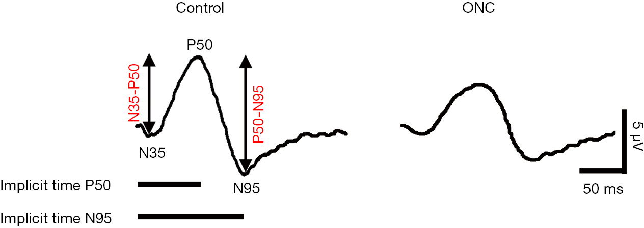 figure4