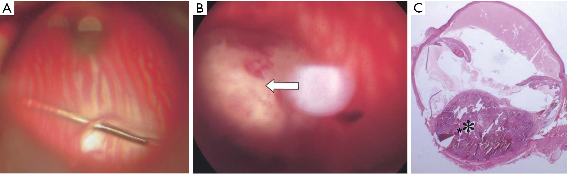 figure3