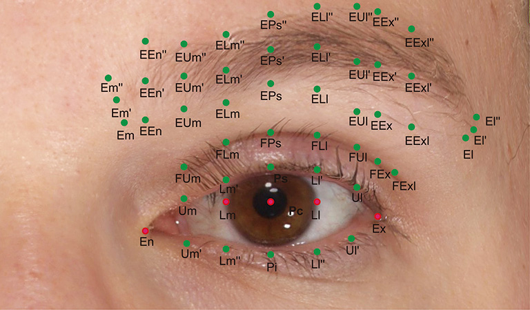 figure1