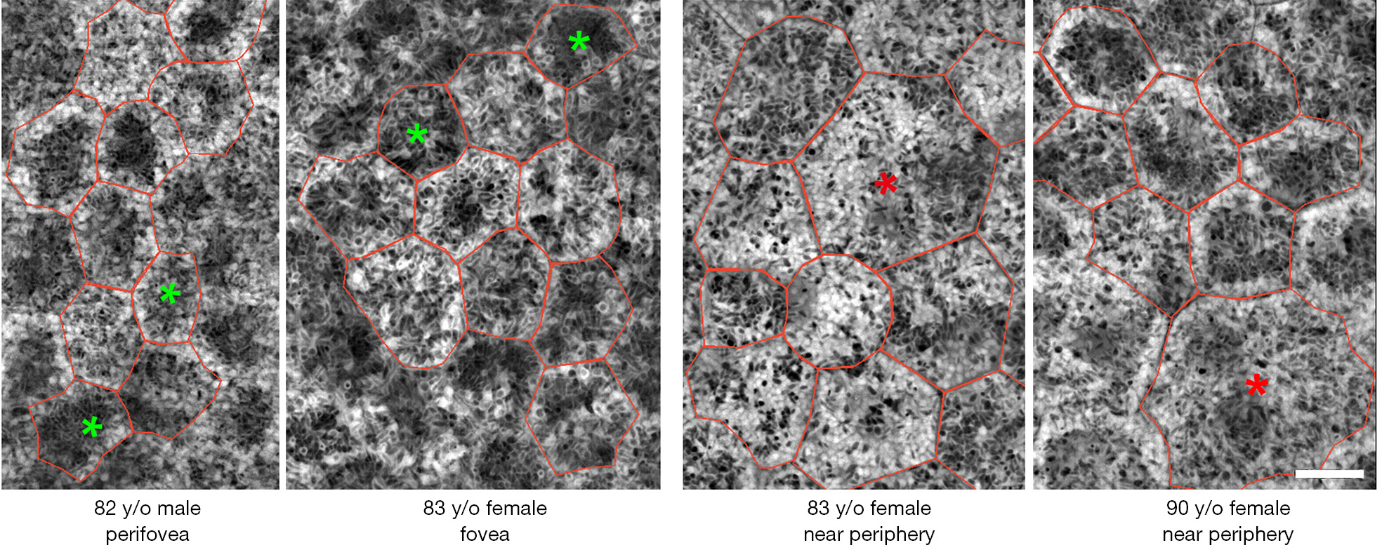 figure1