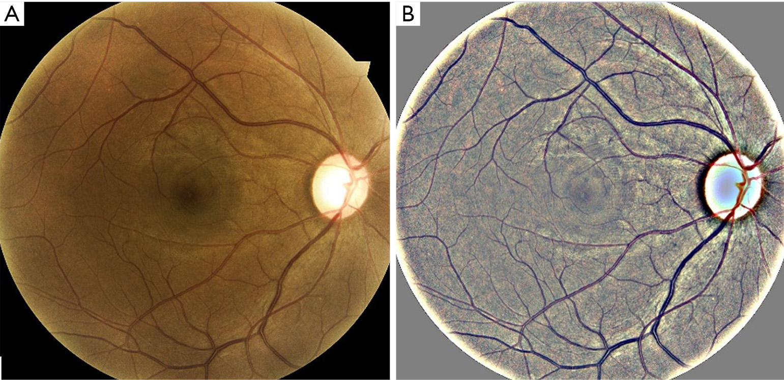 figure2