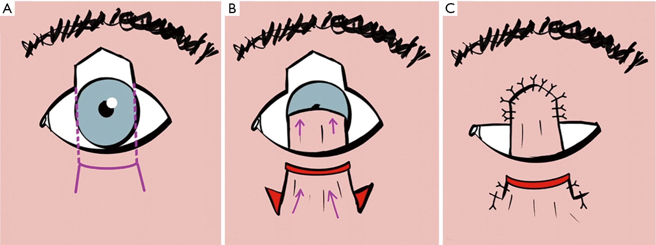 figure3