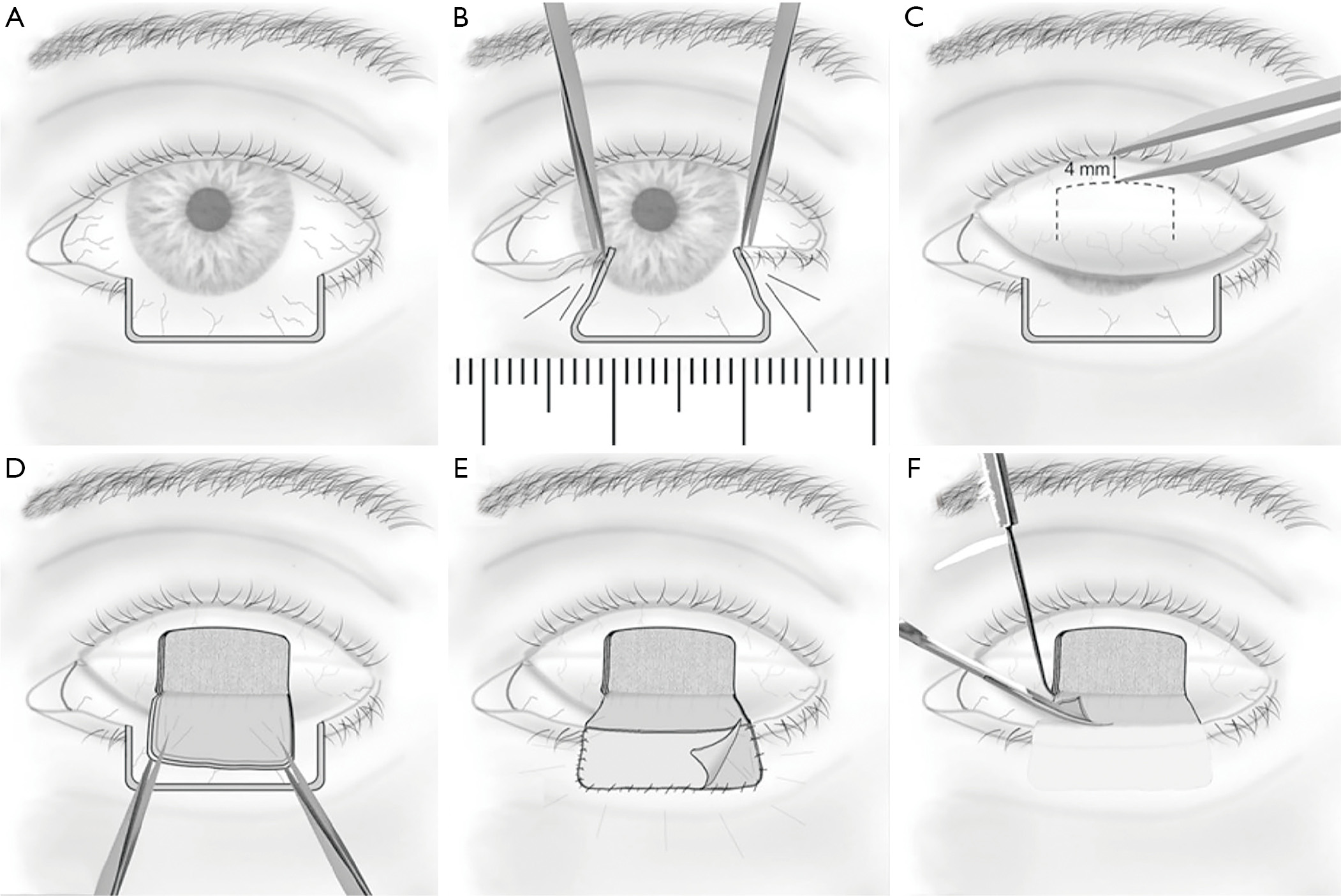 figure4