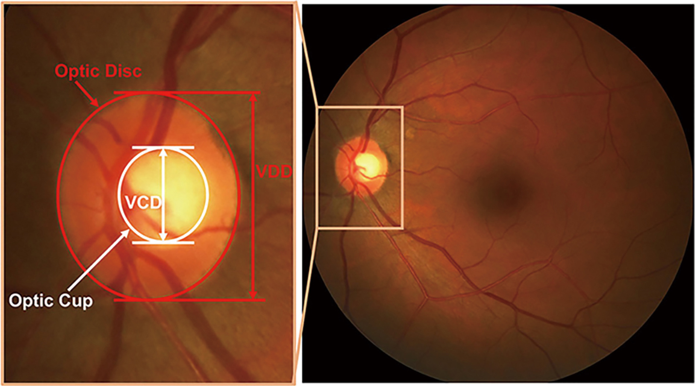 figure1