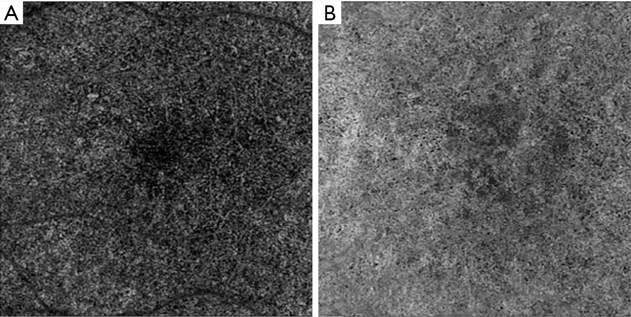 figure2