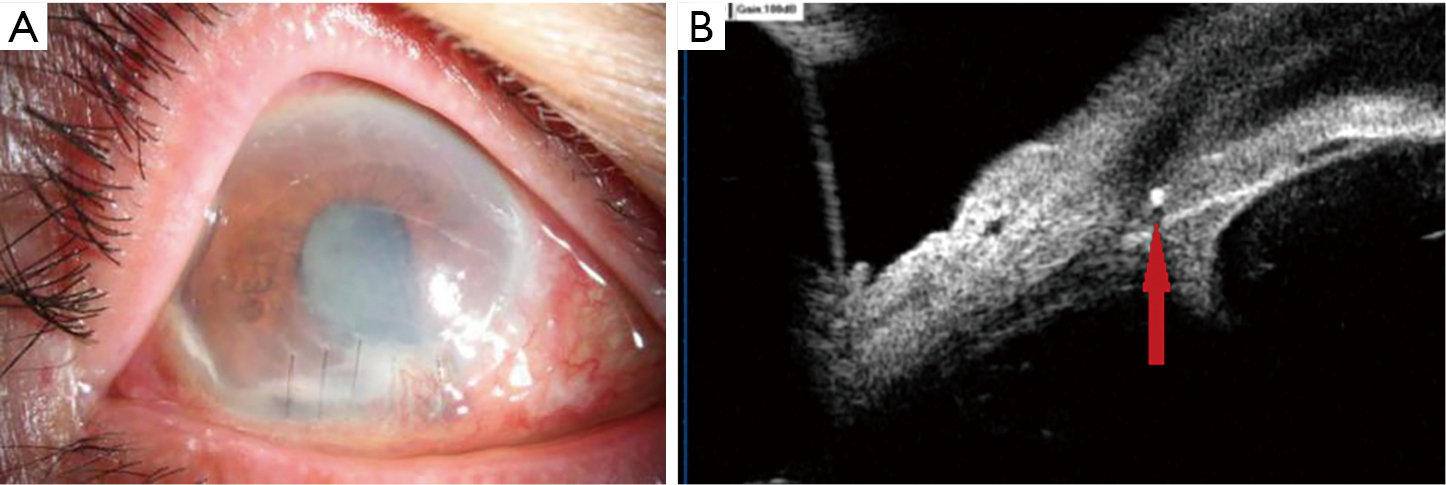 figure2