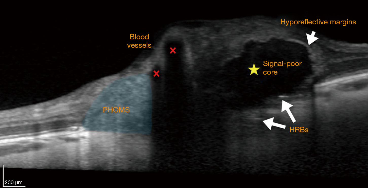 figure3