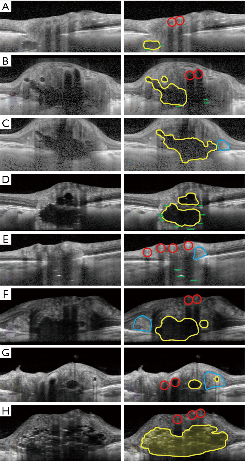 figure4