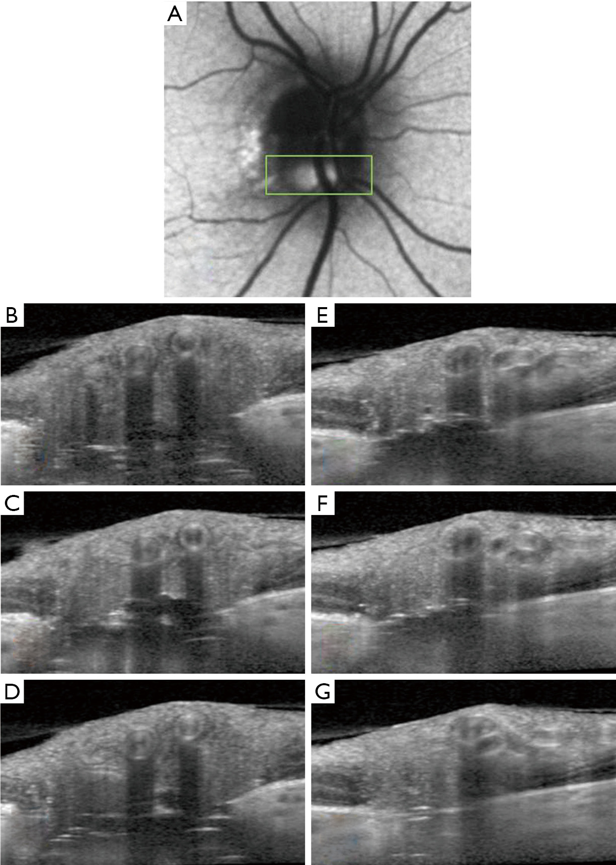 figure5