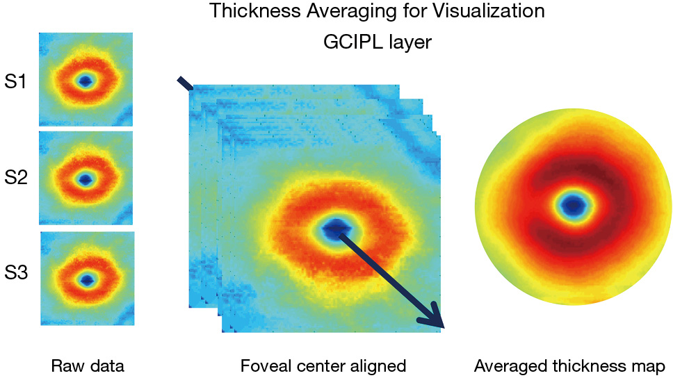 figure1