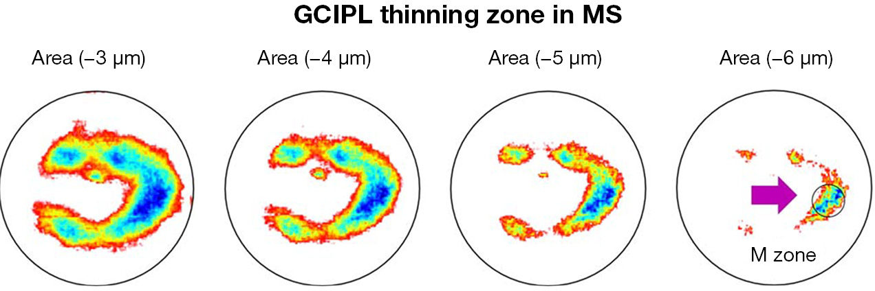 figure4