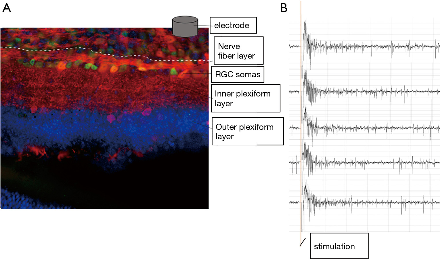 figure2