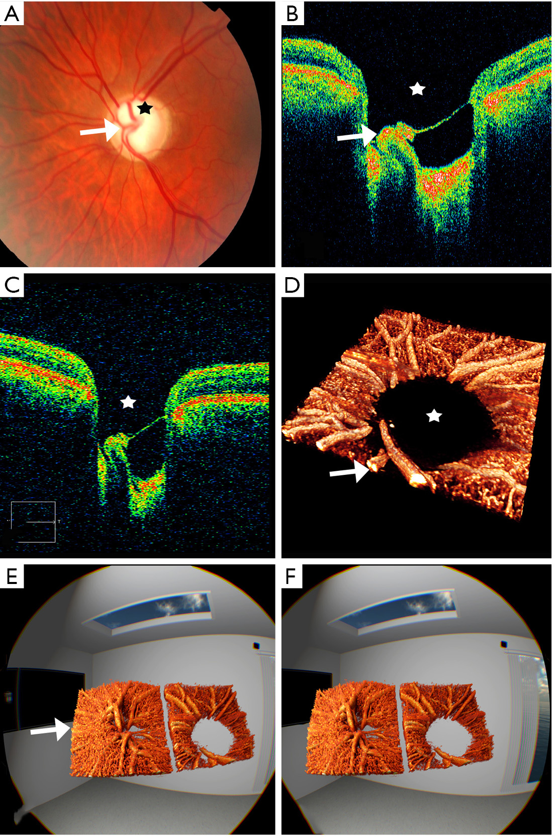 figure1