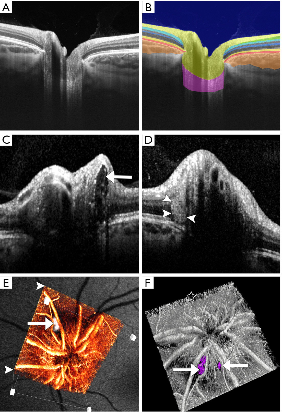 figure2