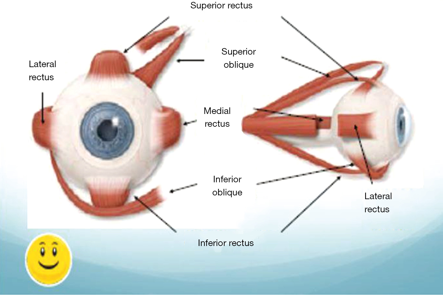 figure2