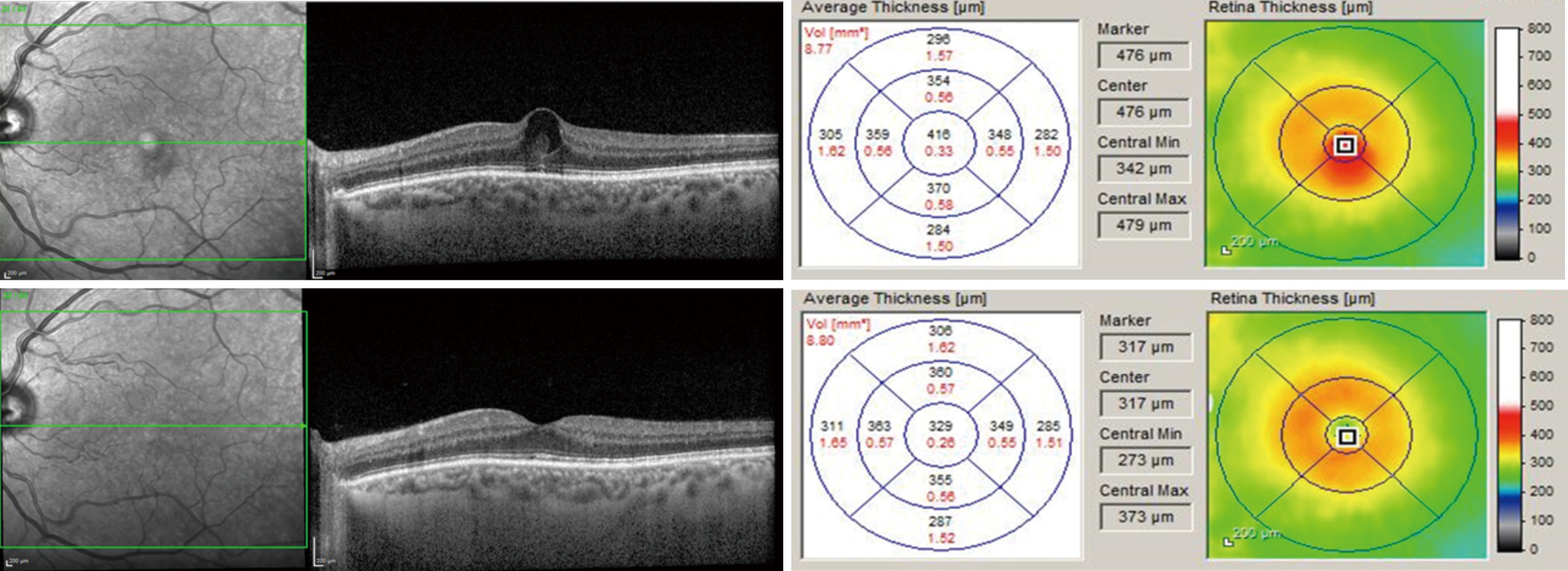 figure1