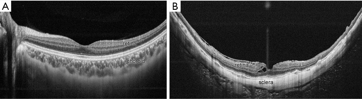 figure3