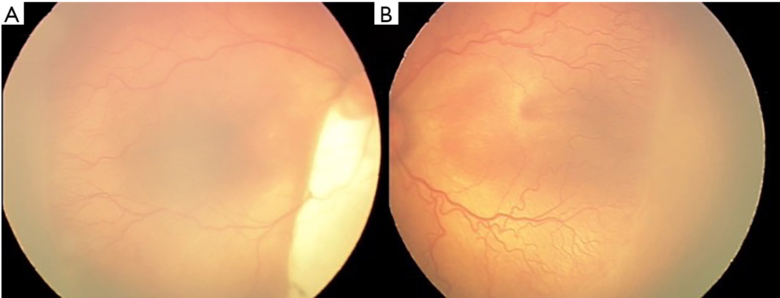 figure2