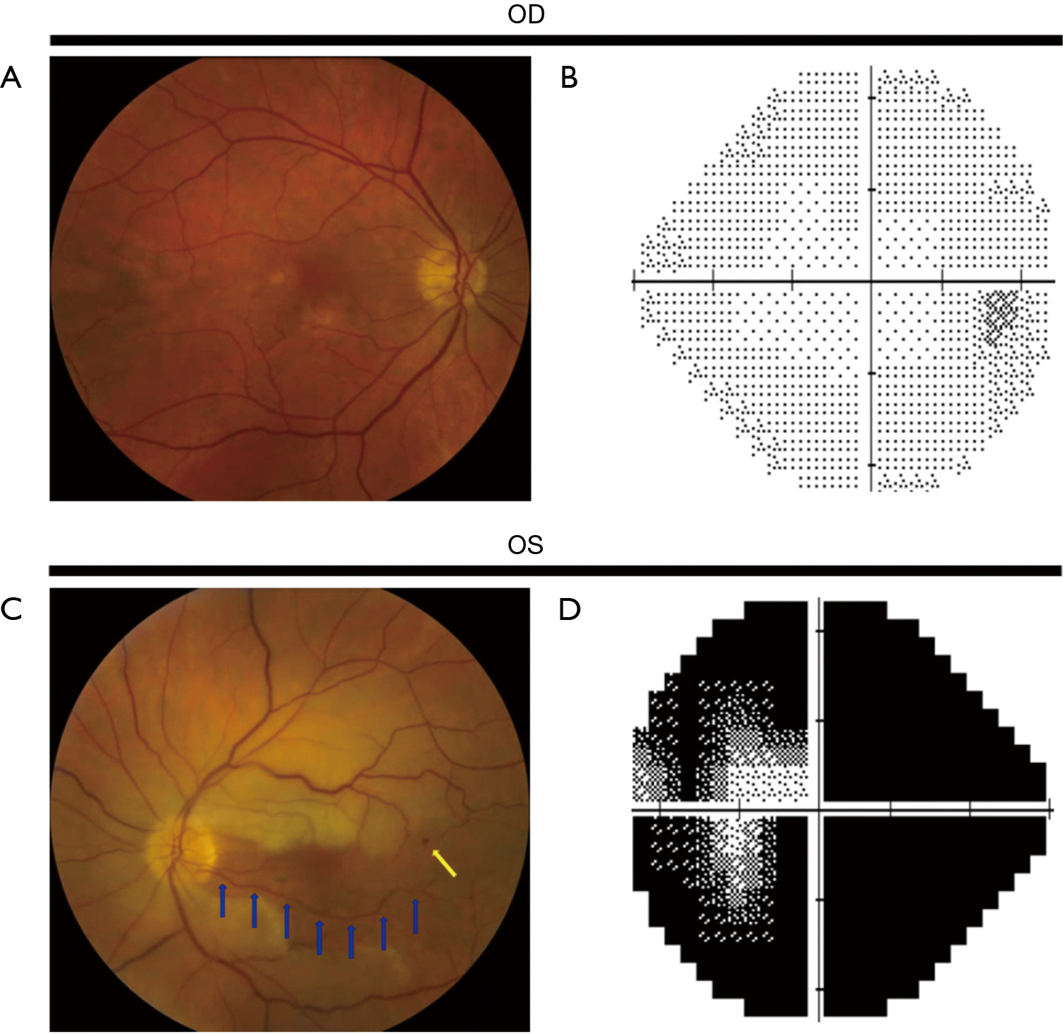 figure1