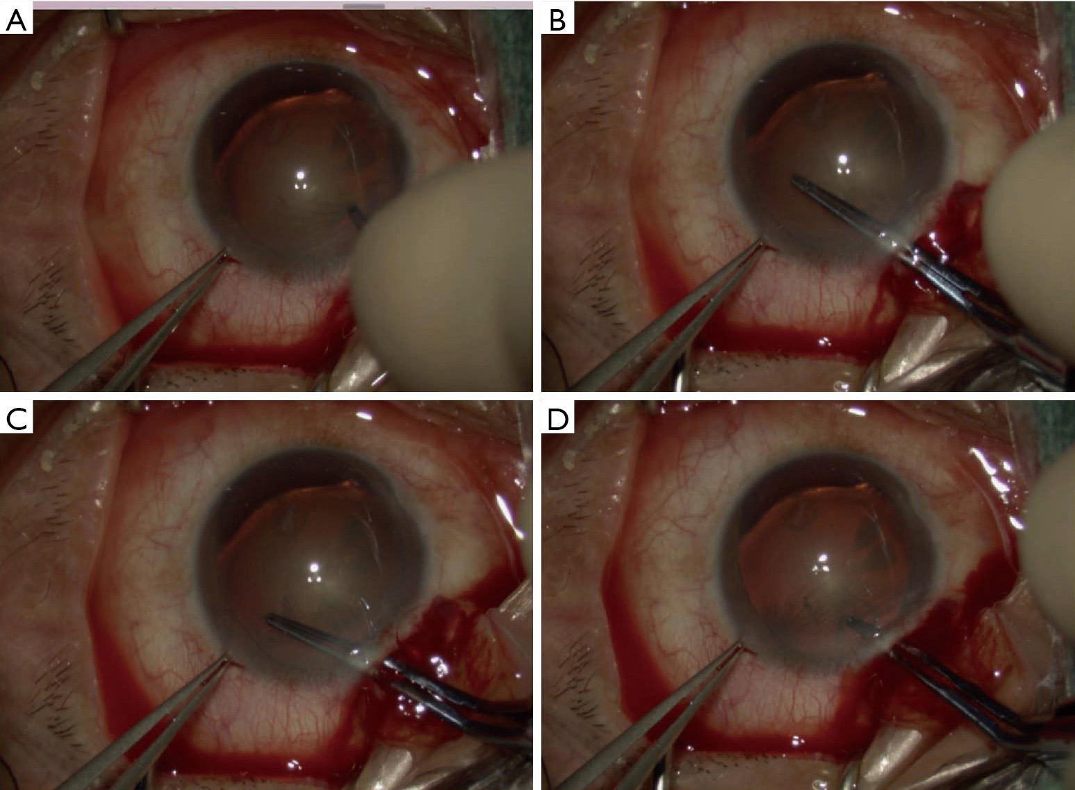 figure2