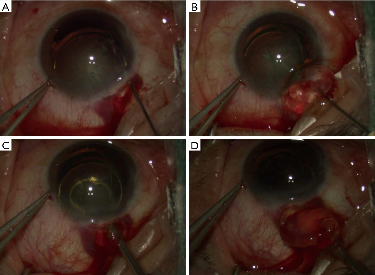 figure3