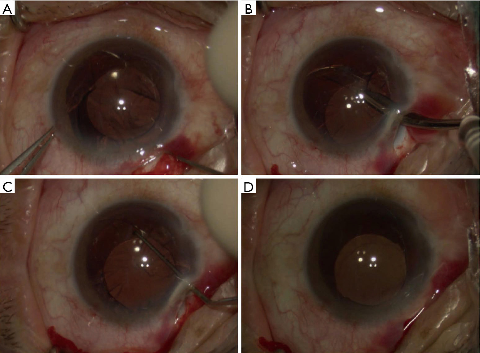 figure4