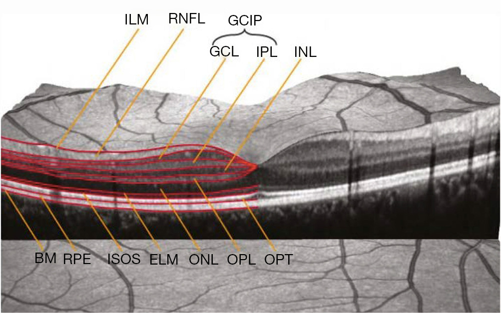 figure1