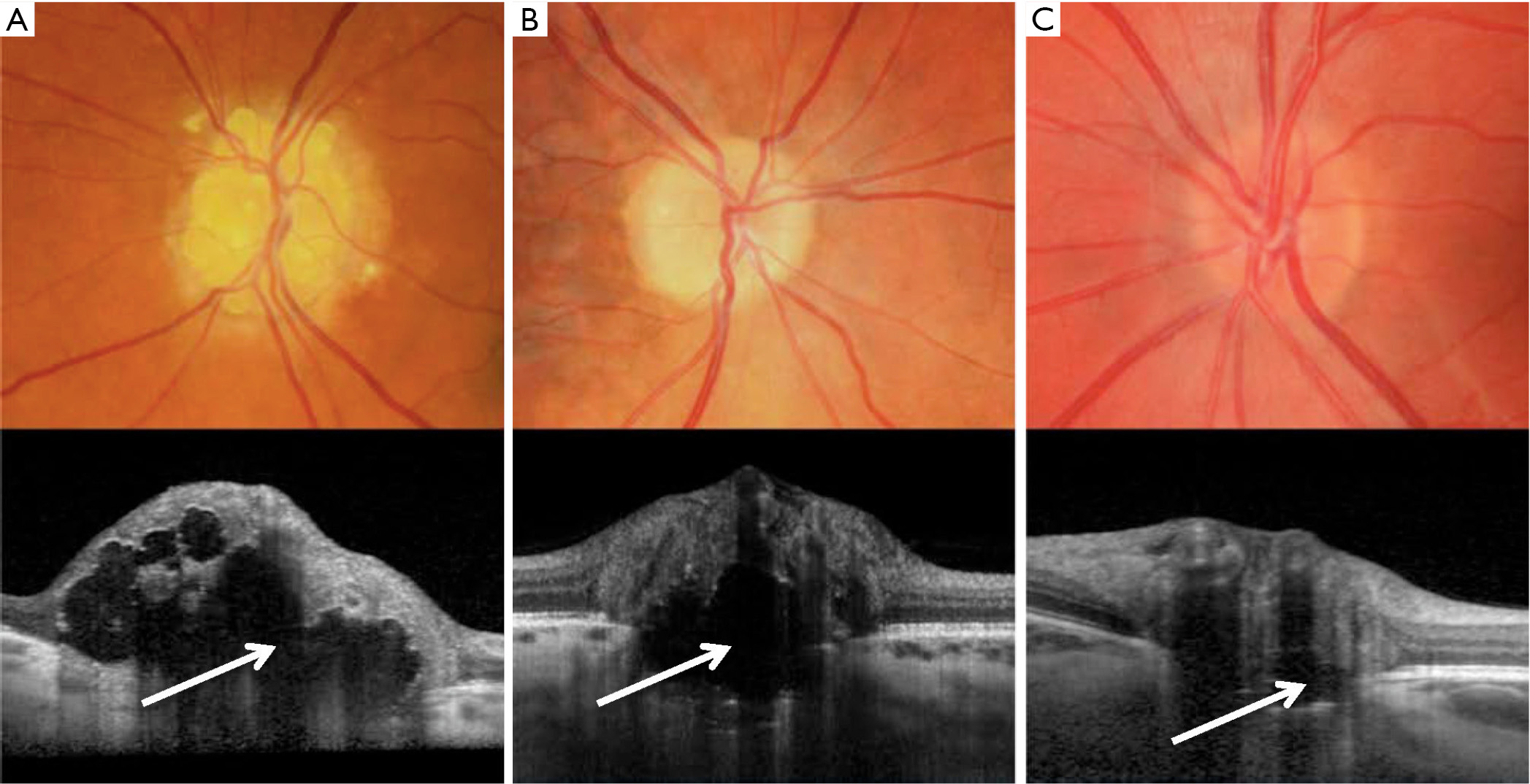 figure3