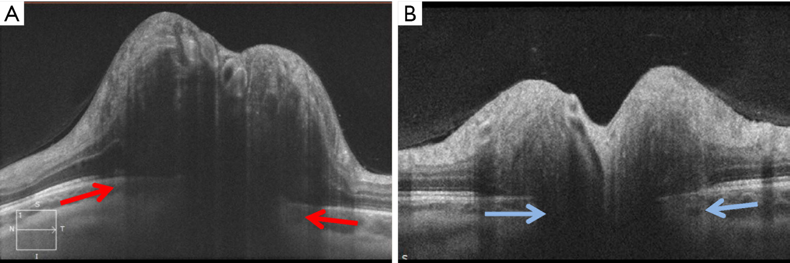 figure4