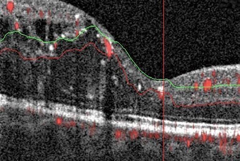 figure3