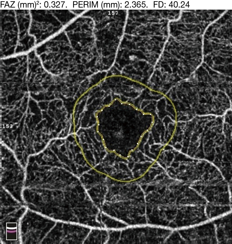 figure5