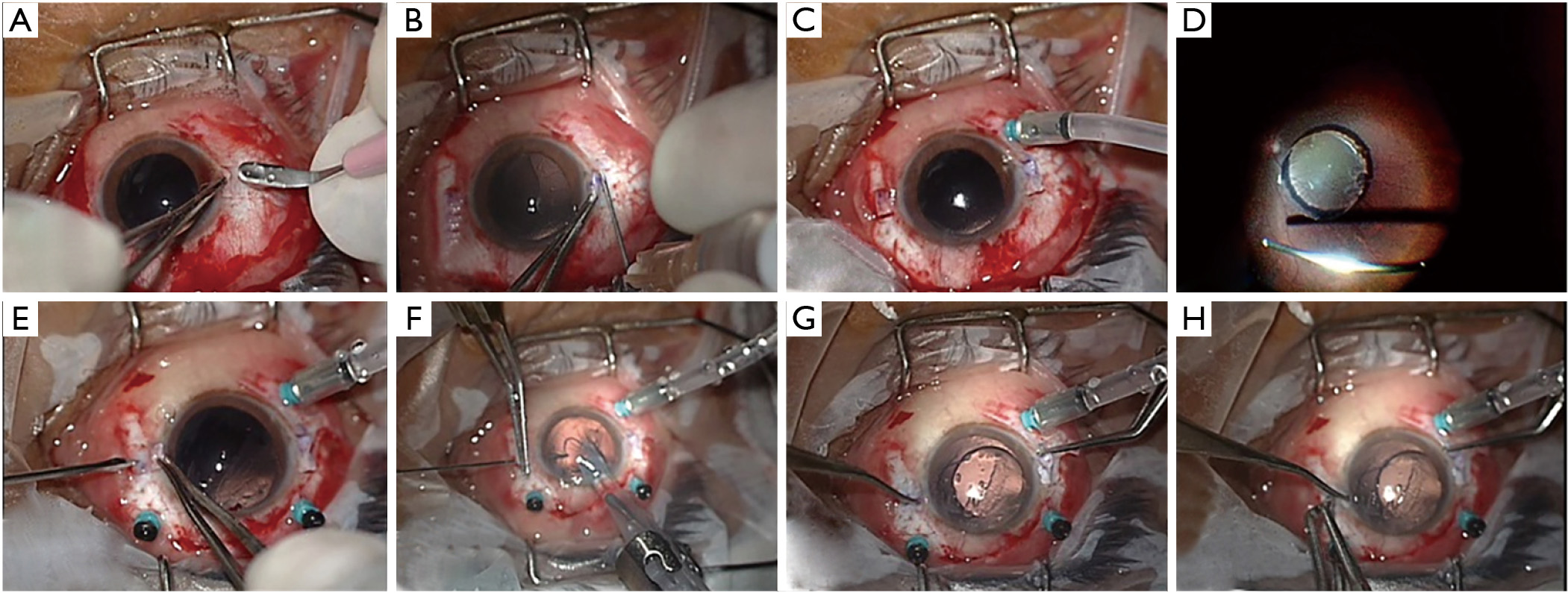 figure1