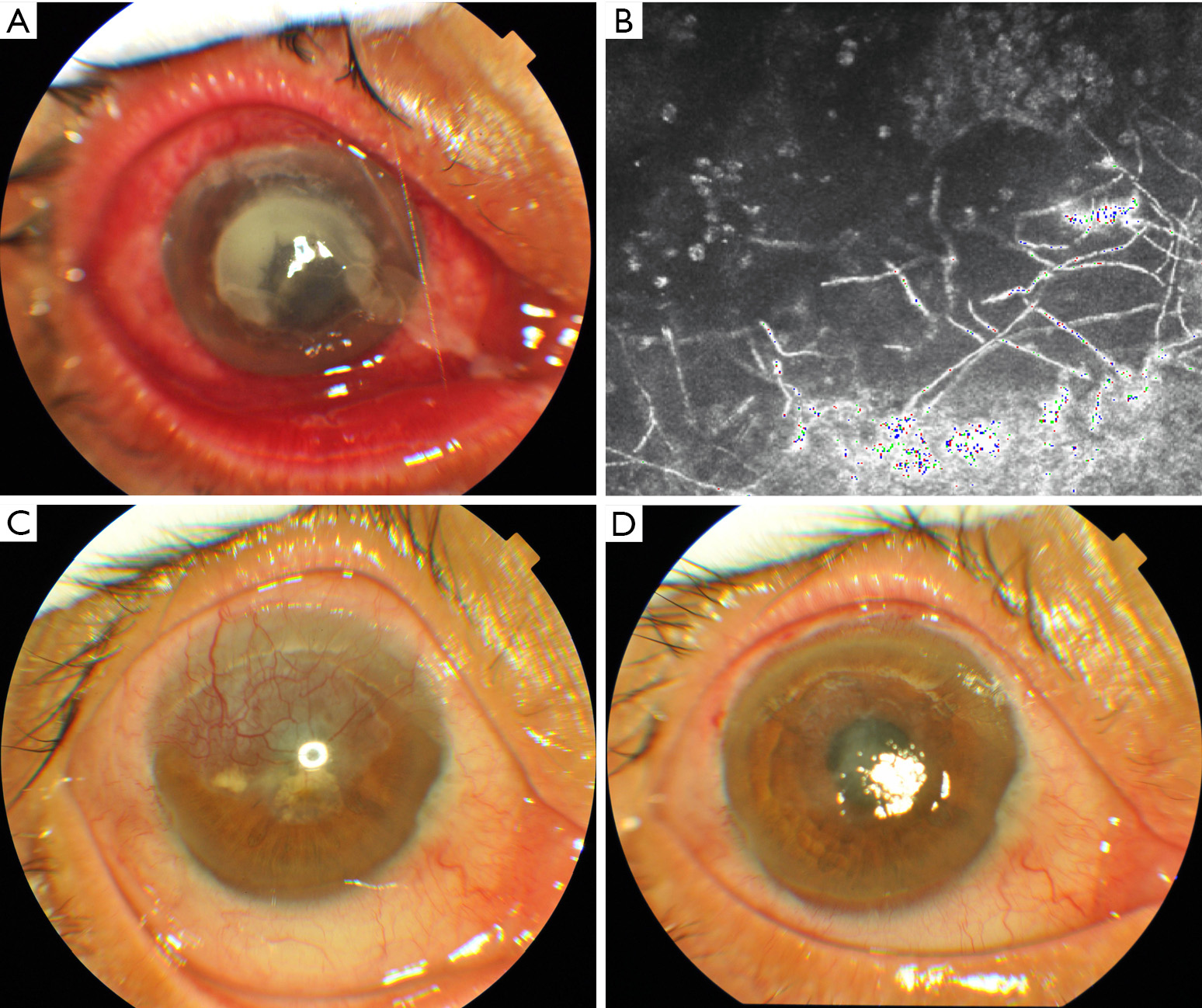 figure1