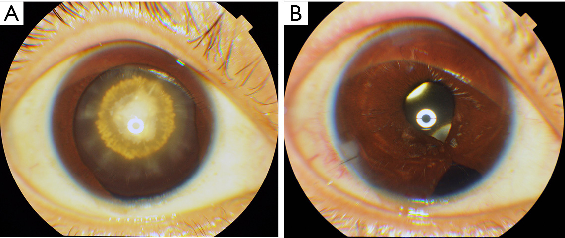 figure2