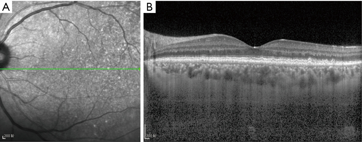 figure3