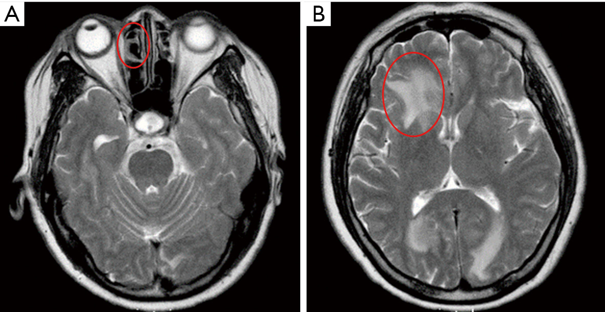 figure5