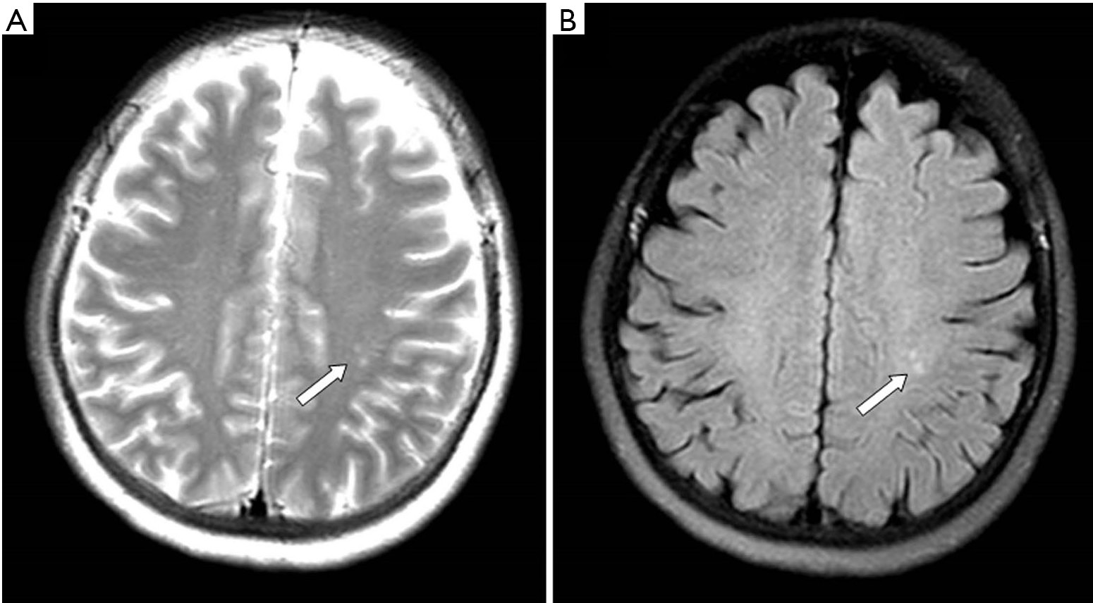 figure1